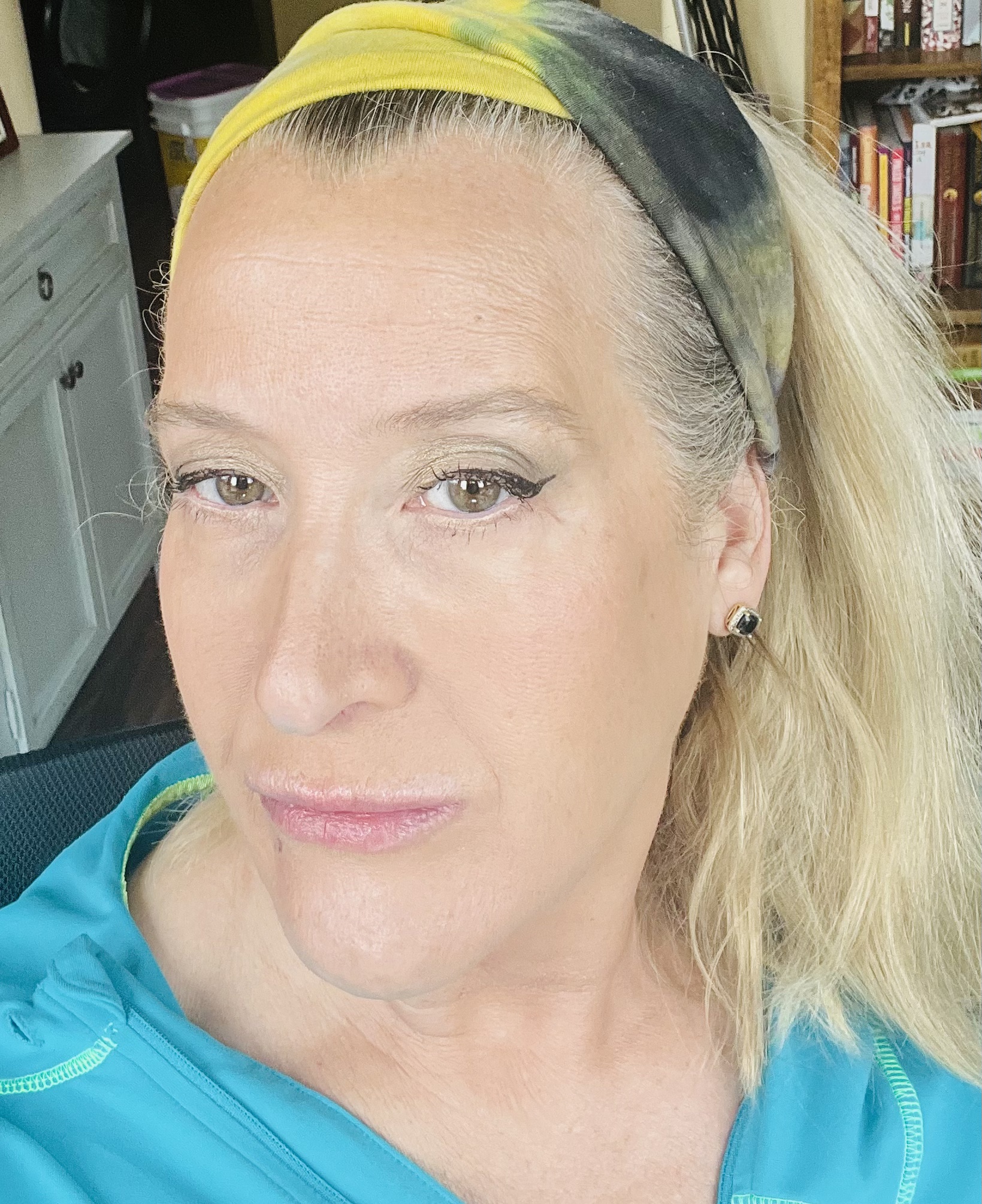 Transform Your Skin: Qure Micro-Infusion Treatment Results